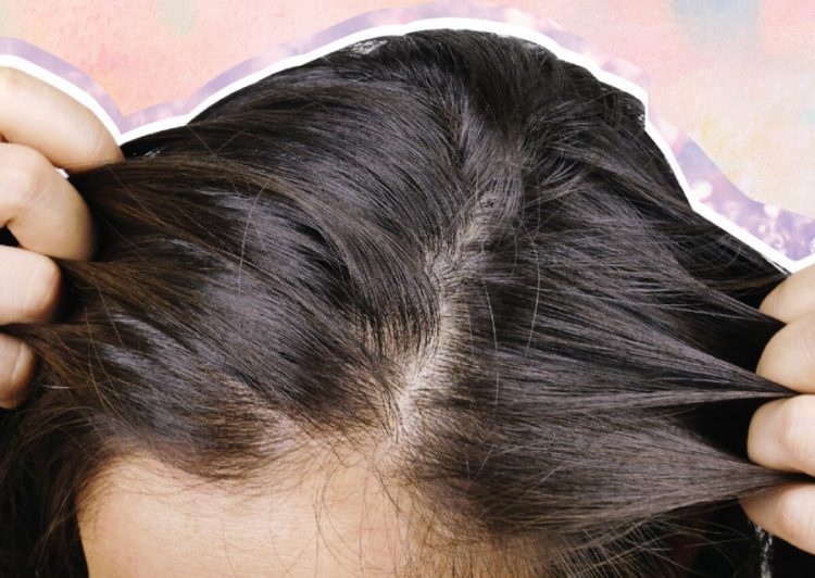 scalp issues
