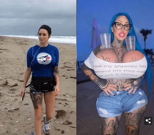 Surgery-addicted social media star with the 'world's fattest vagina' claims she was sexually assaulted.