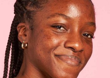 The Different Types of Skin Texture