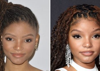 Did Halle Bailey Get Plastic Surgery? The Singer Weighs In