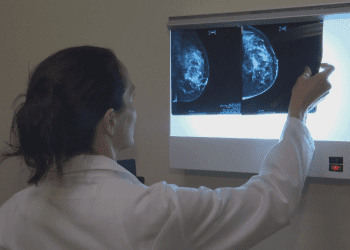 Click to play video: 'Ask an Expert: breast cancer awareness'