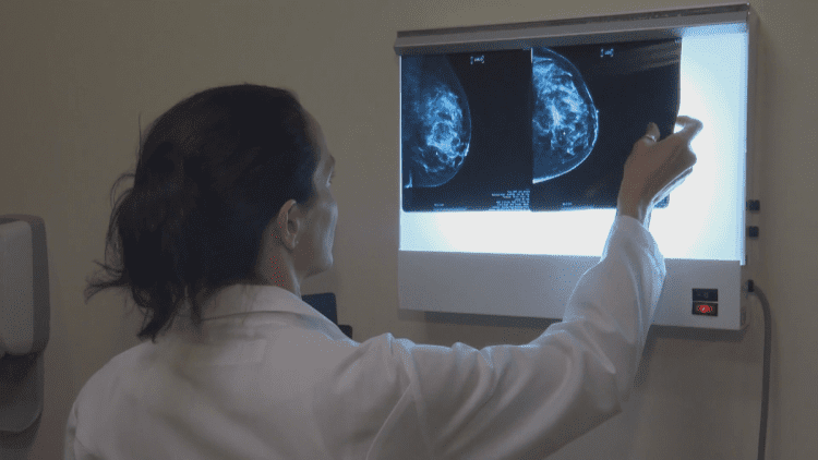Click to play video: 'Ask an Expert: breast cancer awareness'