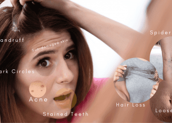 Top Beauty Problems Women Face And Tips To Treat Them, Barbies Beauty Bits