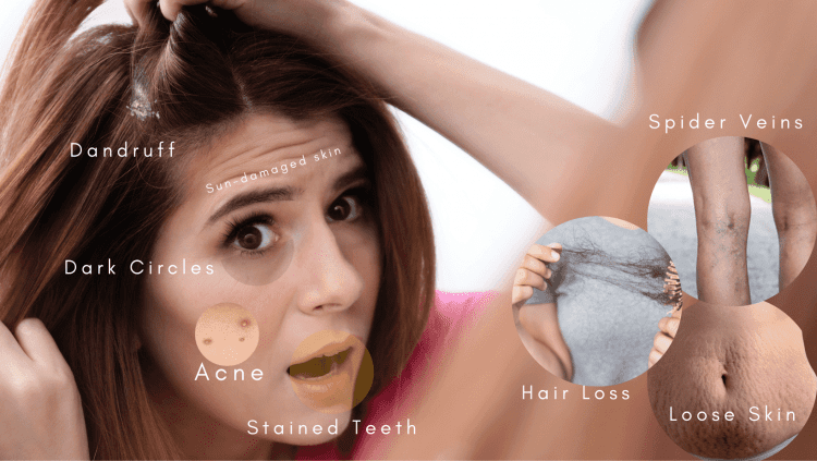 Top Beauty Problems Women Face And Tips To Treat Them, Barbies Beauty Bits