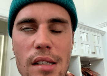 Justin Bieber Suffers From Virus That Causes Face Paralysis, Forcing Cancellation Of Several Tour Dates