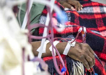 A partial view of a person having dialysis that shows twisting intravenous tubes going into one forearm arm; his other hand is on top of a plaid blanket