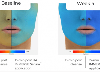 This Award-Winning Hyaluronic Acid Serum Is a Game Changer for Dry Skin