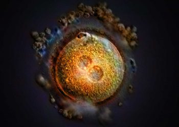 As states try to define when life begins, science, religion and politics clash : Shots