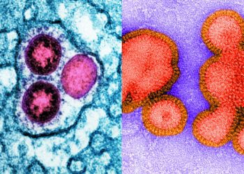 Flu season could be rough this year : Shots