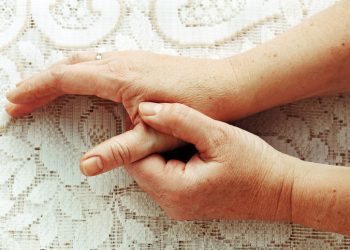 A woman's hands and forearms on a background of lace; painful arthritis in the thumb joint