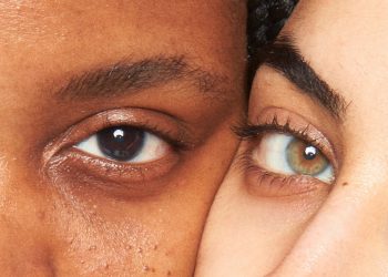 How Your Skin Tone Can Impact Your Dark Circles