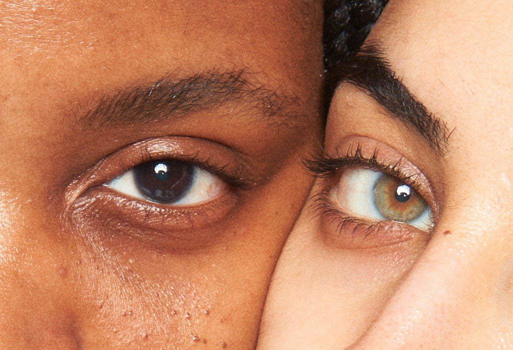 How Your Skin Tone Can Impact Your Dark Circles