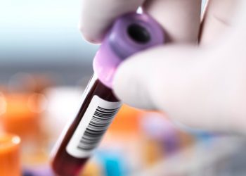 Why Syphilis Is Rising in the U.S. and What Symptoms Are