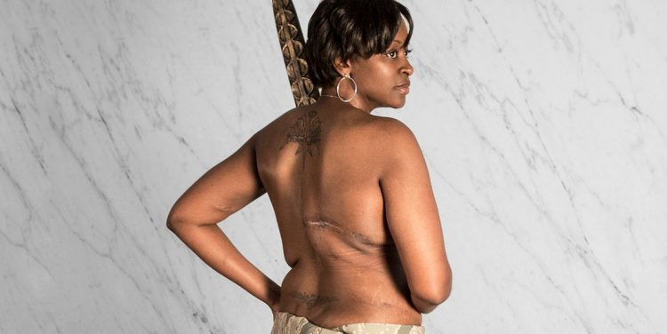 This Photographer Finds Beauty In Breast Cancer Survivors’ Scars