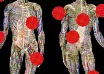 What Doctors Still Don’t Understand About Long COVID