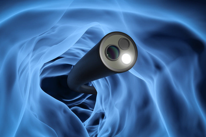 A 3-D rendering of a lit, flexible endoscope inside a curve of the colon; background is hazy blue, white, and black