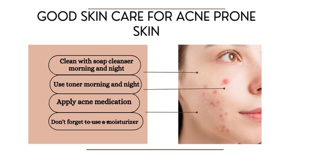 Skin Care For Acne Prone dry Skin